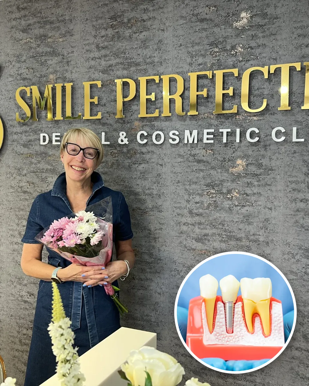 Smile Perfections patient at the clinic reception, with a single implant model inset