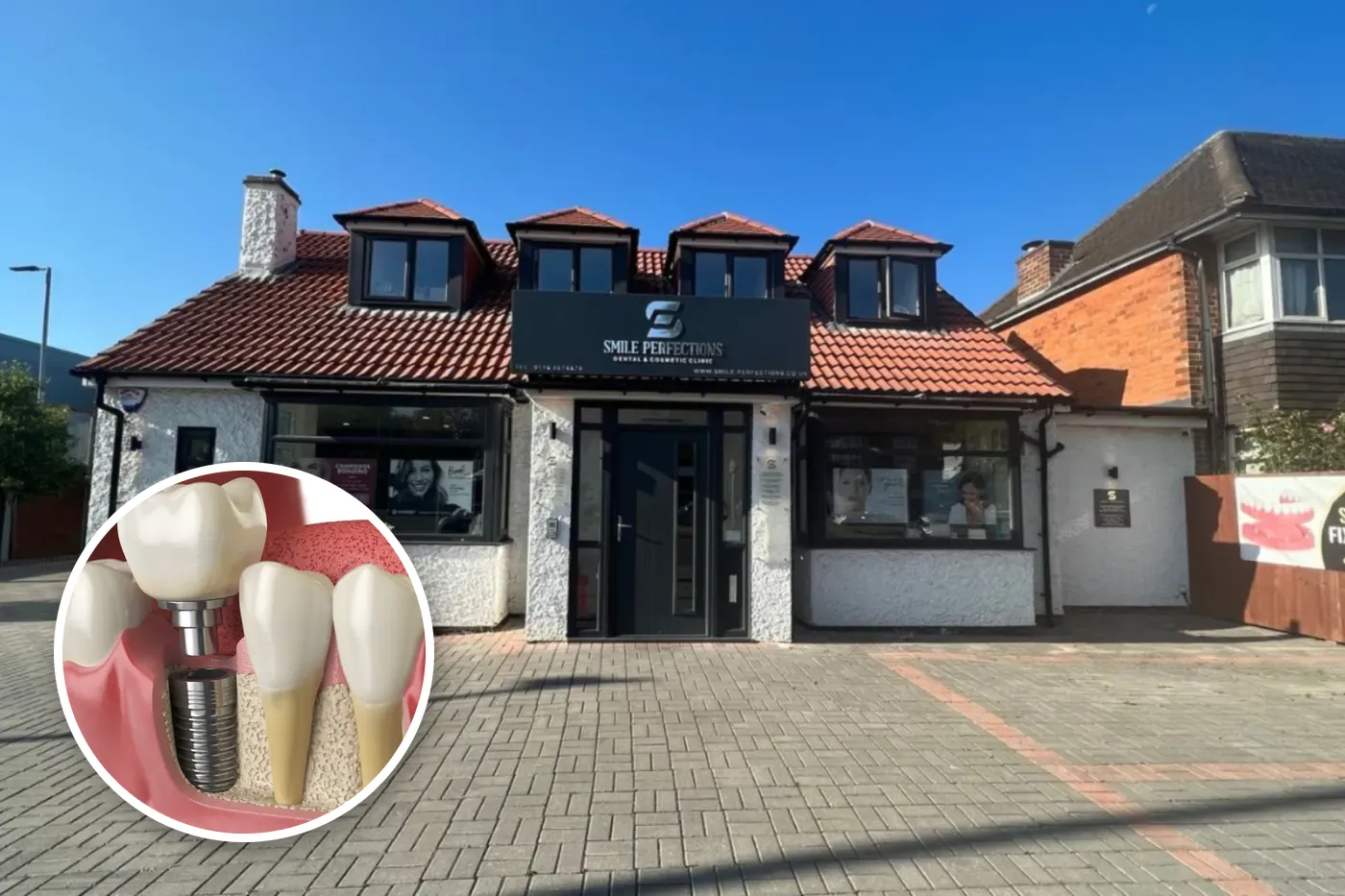 Smile Perfections Dental & Cosmetic Clinic, 34 Harborough Road, Oadby, with a dental implant illustration