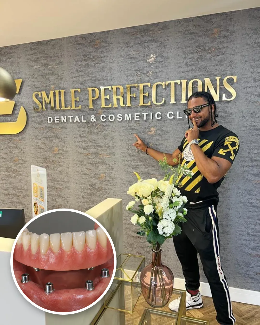 Smile Perfections patient at the clinic reception sign, with an implant-retained denture inset